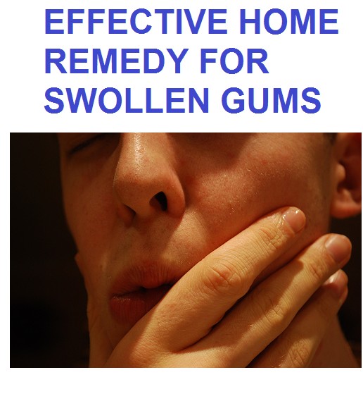 swollen-gums