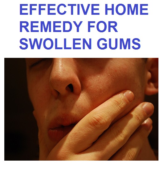 Swollen Gums