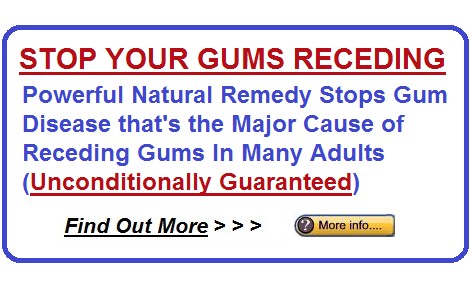 Treatment for Receding Gums
